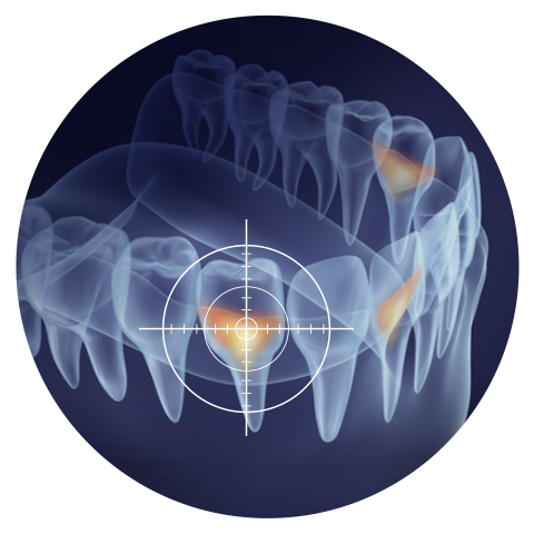 ap_24_teeth1